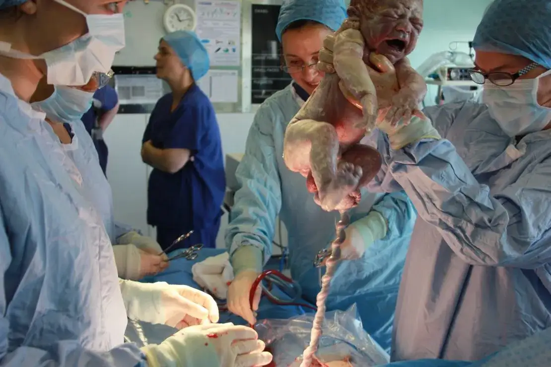 Ile trwa cesarka? Poznaj cały proces: od sali po dom