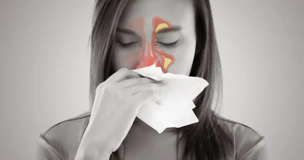 Do jakiego lekarza z zatokami udać się, by uniknąć bólu?