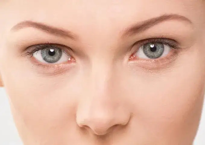 Leniwe oko jak wygląda: objawy, które mogą cię zaniepokoić