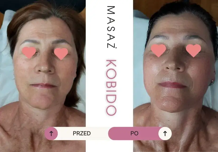 Masaż Kobido jak długo efekty? Odkryj, co warto wiedzieć o trwałości rezultatów
