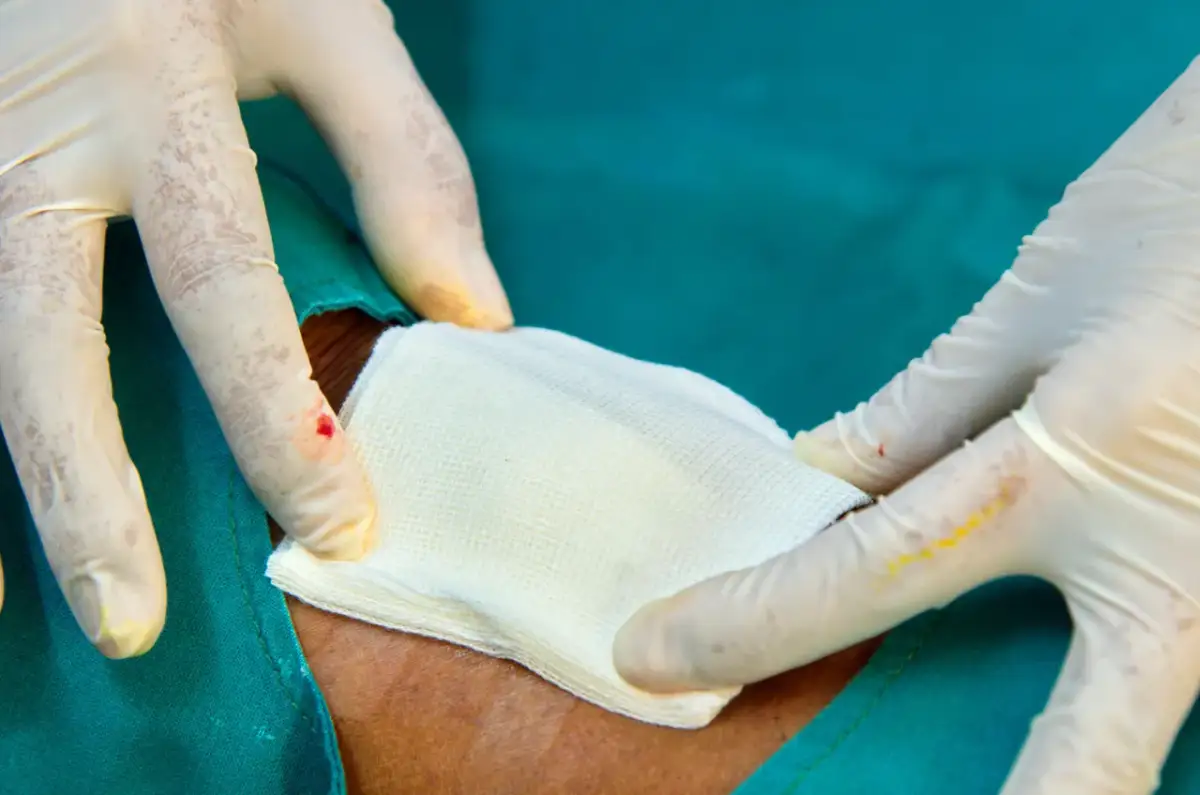 Opiekun medyczny może robić opatrunki. Dłonie w rękawiczkach przykładają gazę do rany.