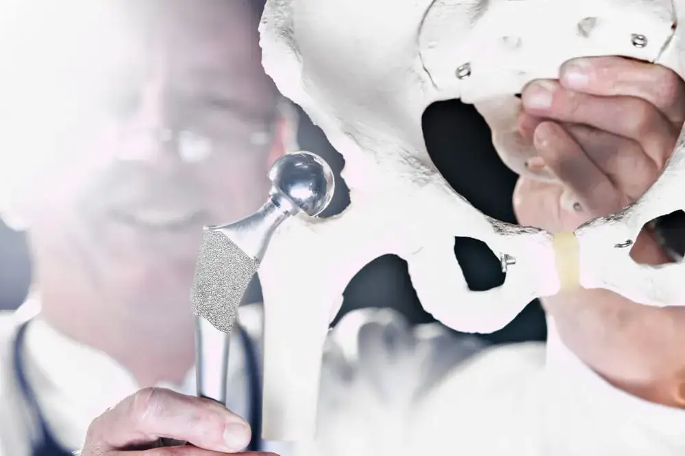 Gdzie najszybciej na endoprotezę stawu biodrowego NFZ z krótkim czasem oczekiwania