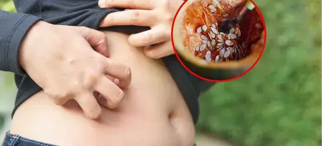 Czy odrobaczanie jest bezpieczne? Poznaj fakty i rozwiej wątpliwości