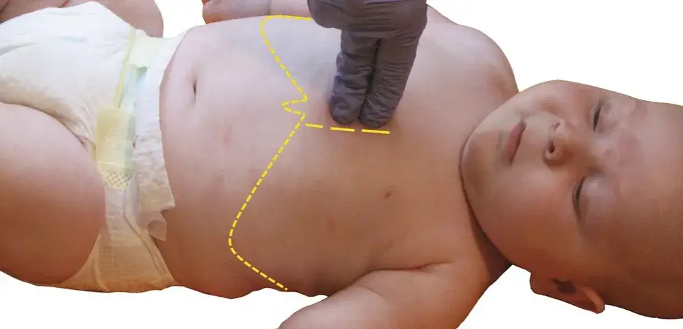 Reanimacja dziecka ile uciśnięć - kluczowe zasady, które ratują życie