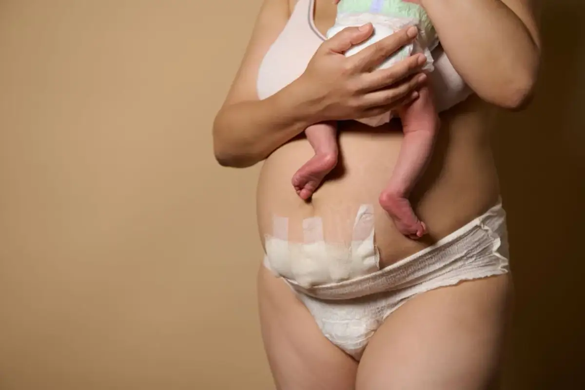 Po cesarskim cięciu, aby złagodzić ból przy kaszlu, warto podtrzymać brzuch.