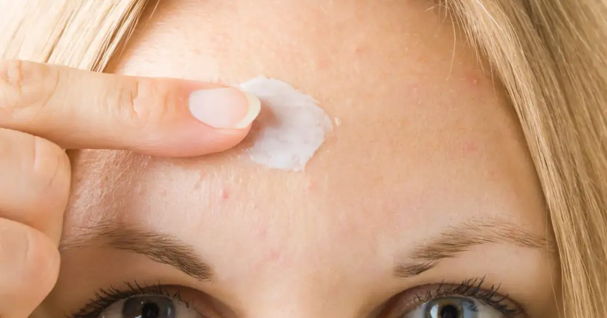 Palec nakłada krem na czoło. To może być złoto z Madagaskaru maść w aptece, pomagająca na drobne niedoskonałości skóry.