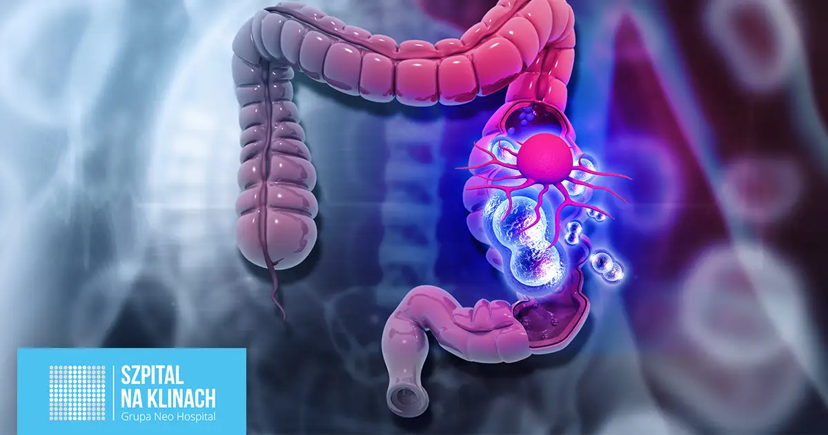 Chirurgia kolorektalna: Co to jest i jak leczy?