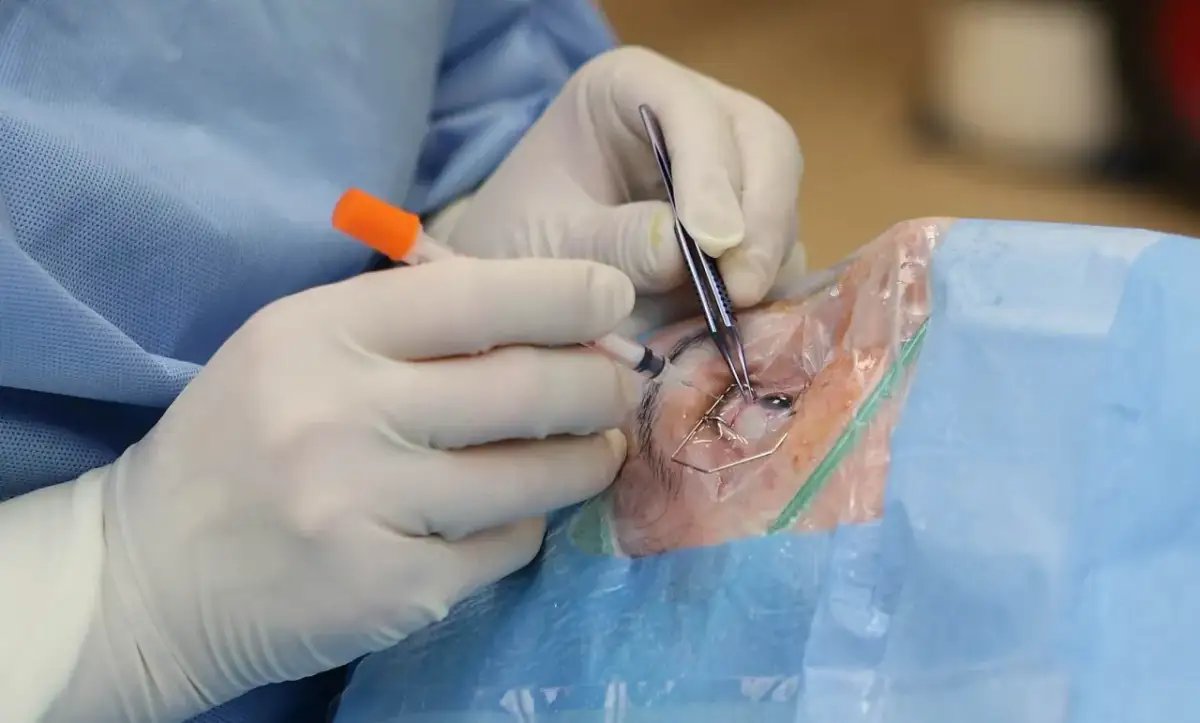 Skutki uboczne Avastinu: prawdziwe doświadczenia pacjentów na forum