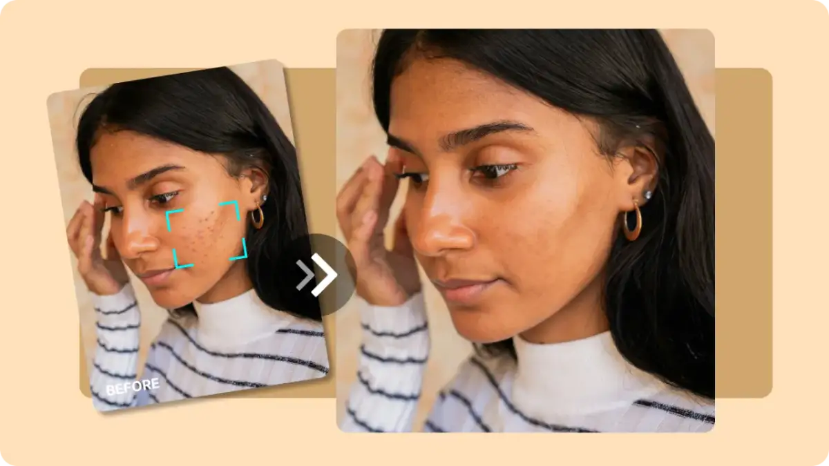 Przed i po: jak szybko usunąć pryszcz. Kobieta z niedoskonałościami skóry, a następnie z gładką cerą.
