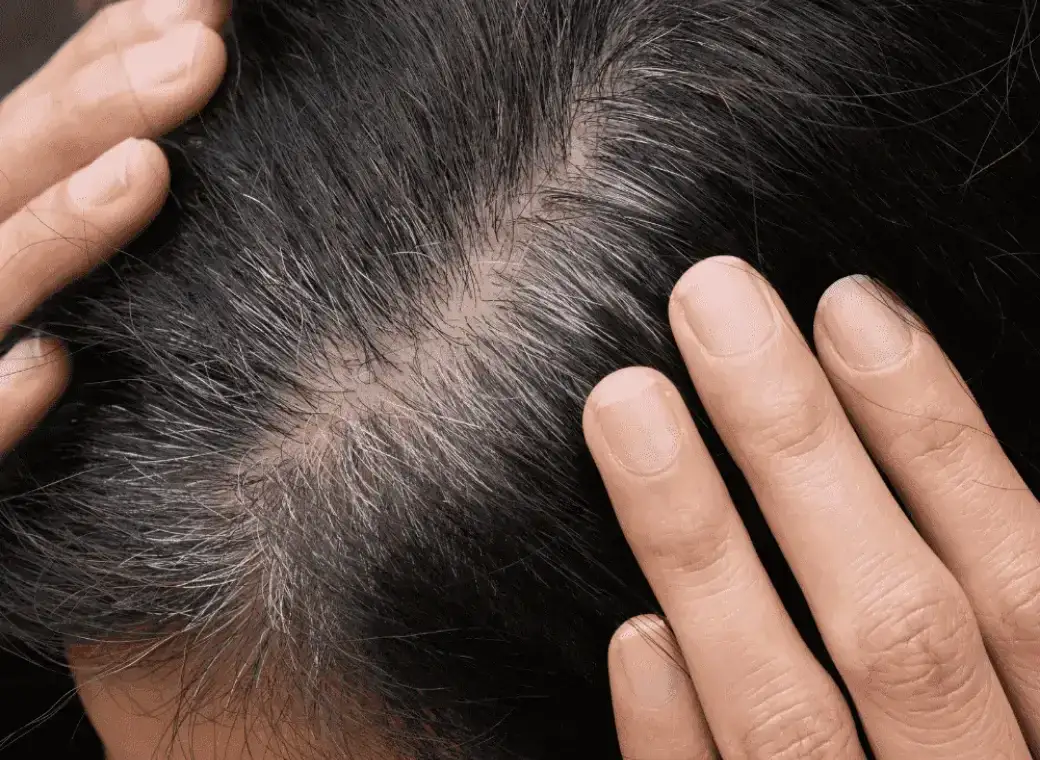 Jak zamaskować siwe odrosty bez farbowania? Oto skuteczne metody