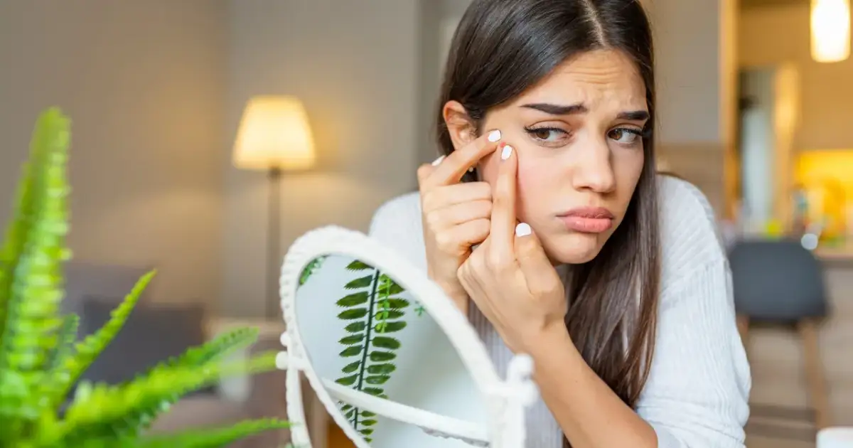 Pryszcze na policzkach: Twoje lustro zdrowia. Przyczyny i rozwiązania