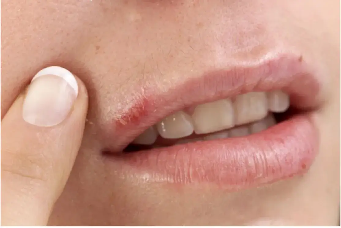 Niedobór selenu objawy: Jak rozpoznać skutki braku selenu?