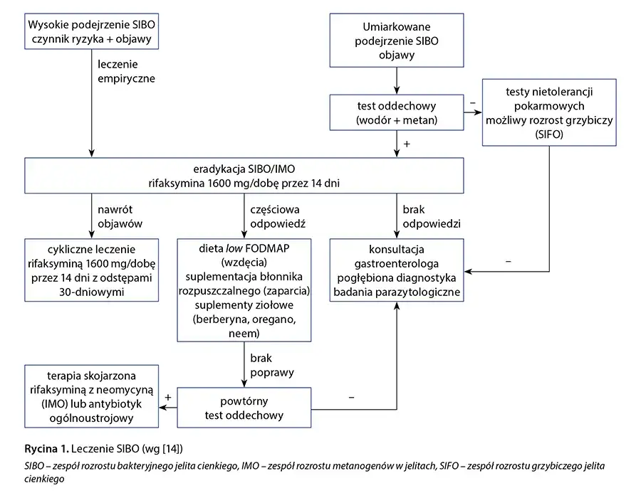 SIBO do jakiego lekarza? Kluczowe informacje dla pacjentów