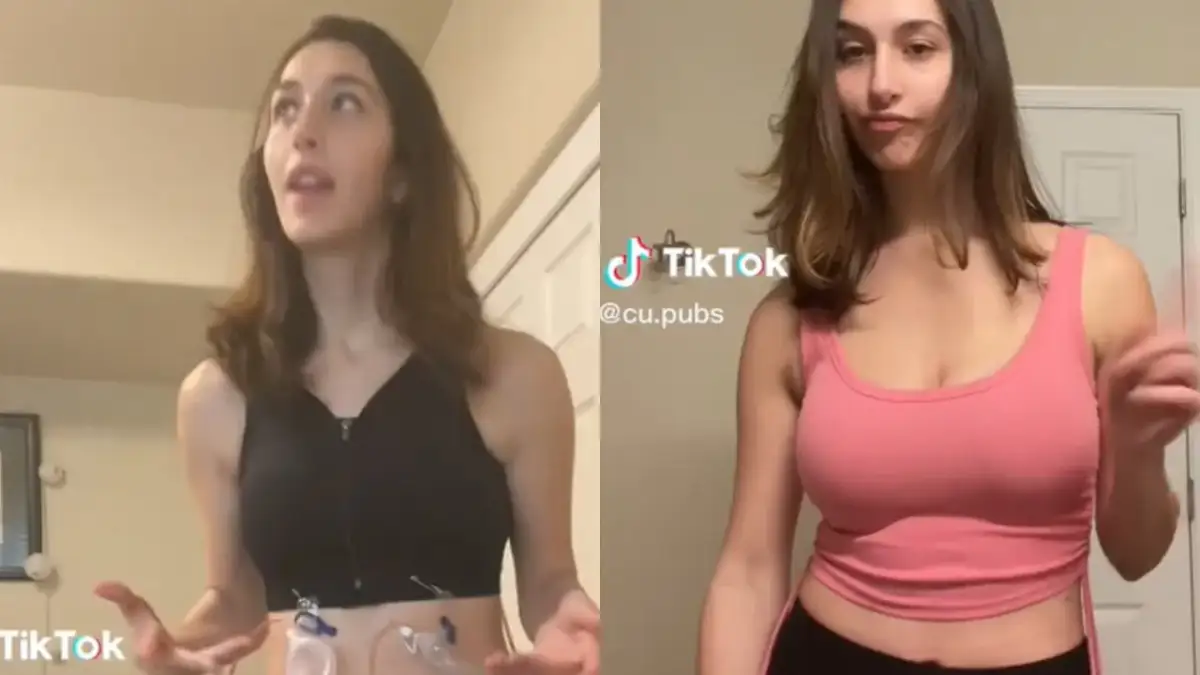 Ile kosztuje zmniejszenie biustu? Pełny przewodnik po cenach i NFZ