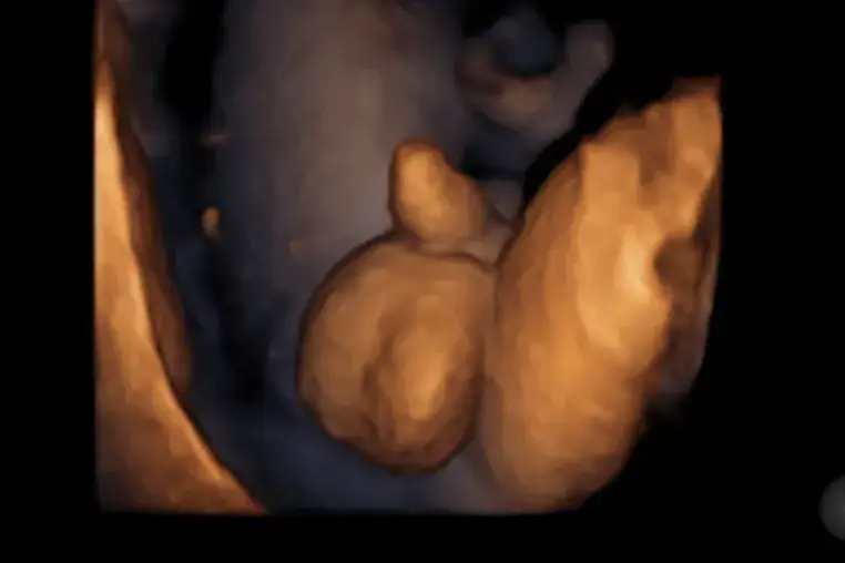 Płeć dziecka w ciąży: Kiedy USG i NIPT dają pewność?