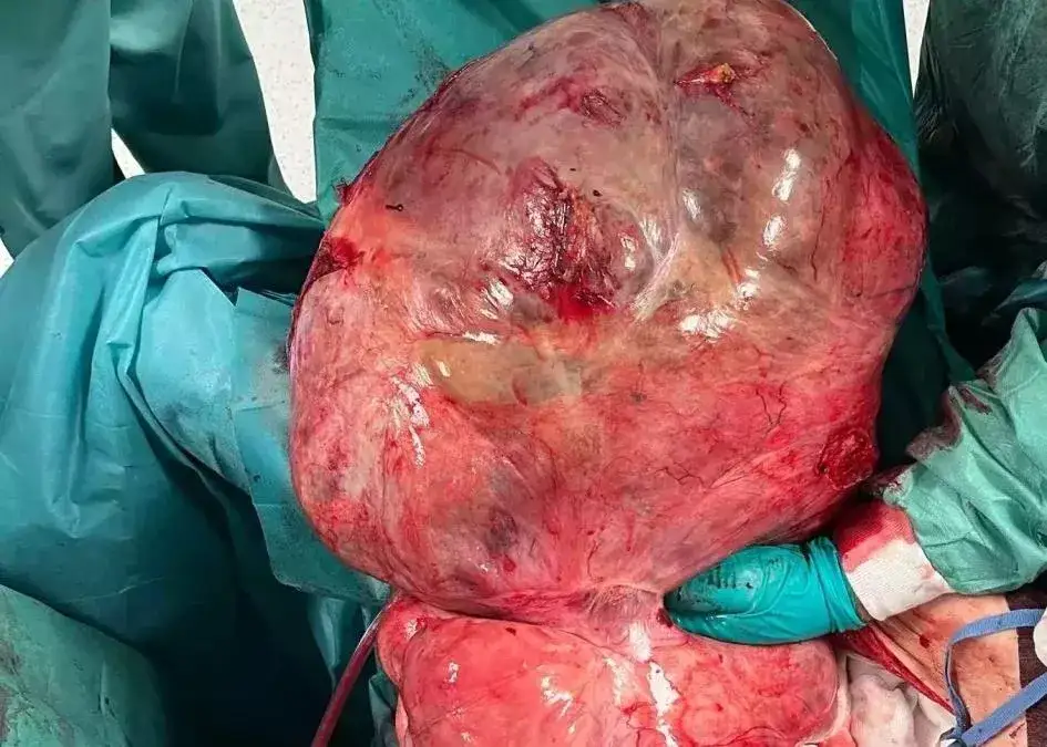 Chirurgia biała vs czerwona: Kluczowe różnice i co to znaczy dla Ciebie