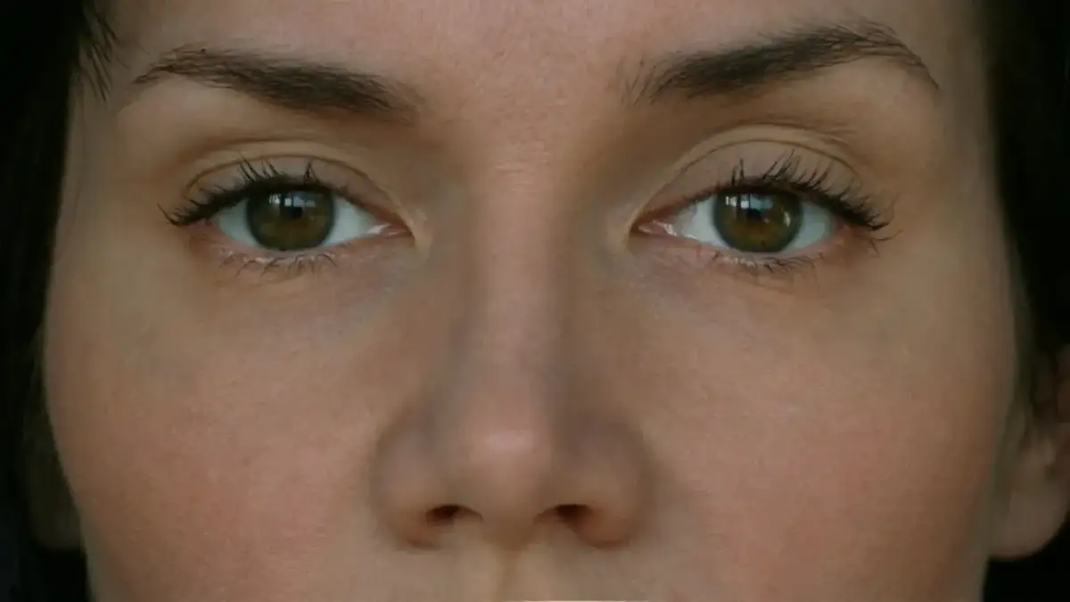 Botoksu nie da się rozpuścić: Co robić po nieudanym zabiegu?