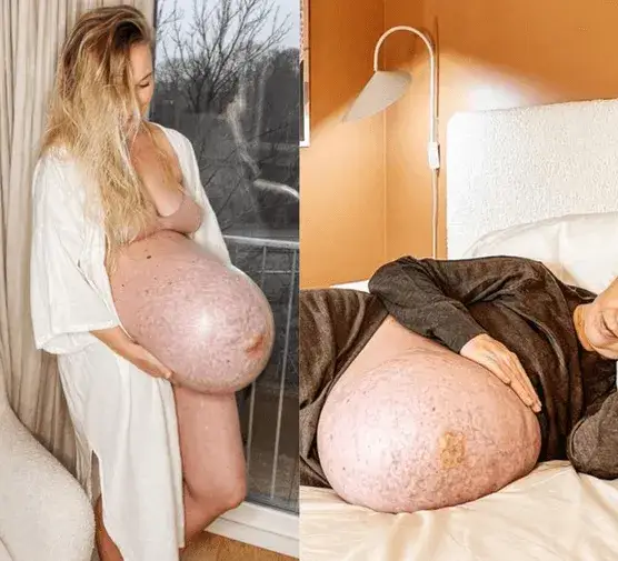 Ile przed porodem opada brzuch? Rozpoznaj sygnały i czas!