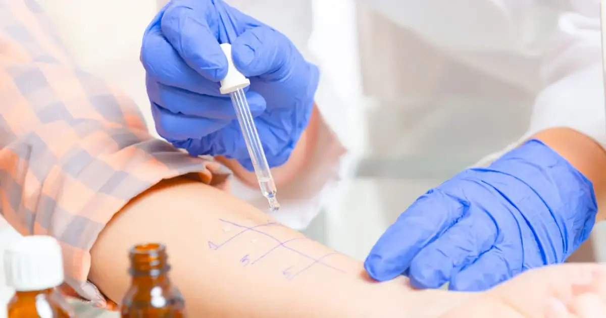 Alergia: Lekarz rodzinny zleci testy NFZ? Nowe zasady 2023