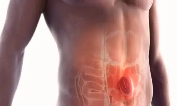 Kiedy można ćwiczyć po operacji przepukliny pępkowej bez ryzyka?