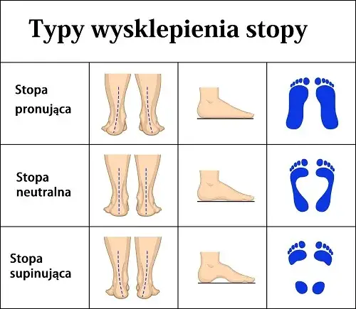 Jak wybrać buty do biegania? Poznaj typ stopy, uniknij kontuzji.
