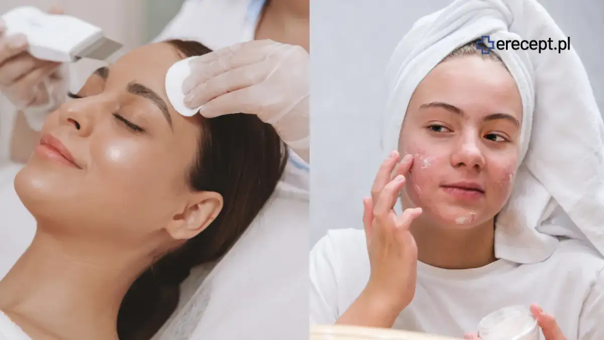 Leki na trądzik: Co wybrać? Przewodnik po terapiach OTC i Rx