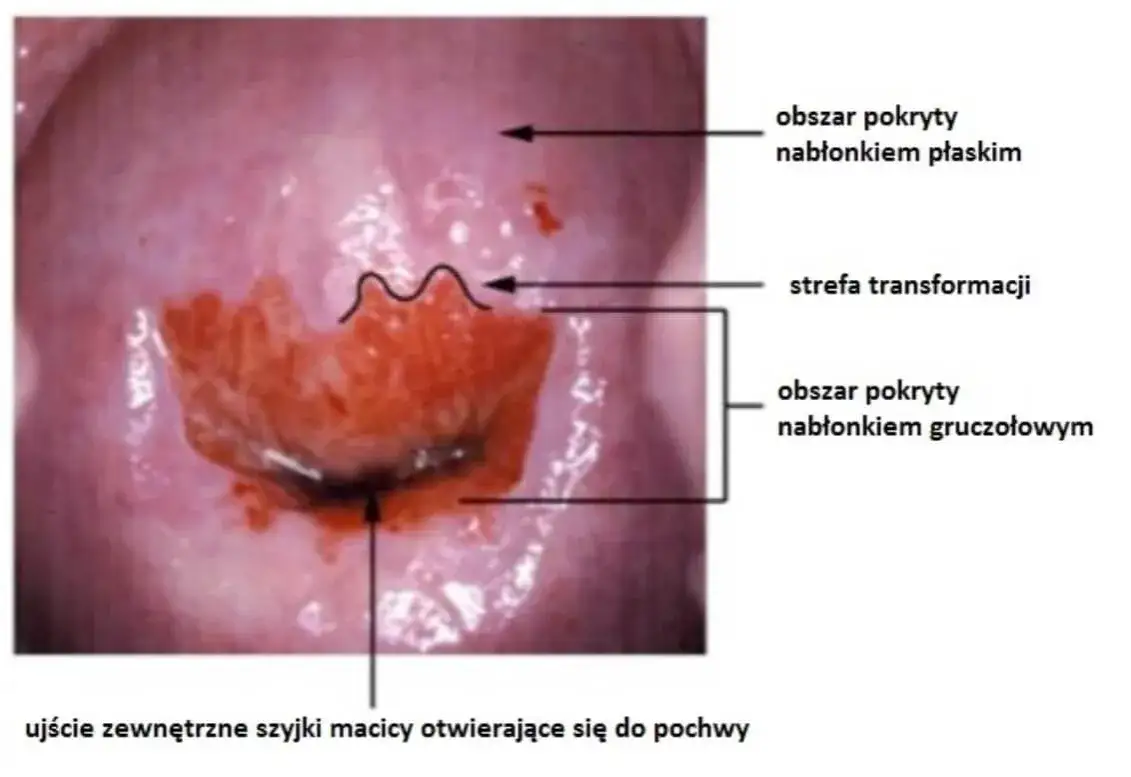 Leki na nadżerkę: żołądka i szyjki macicy. Co działa?