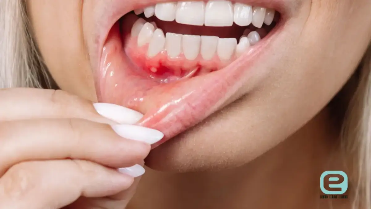 Dziecko ma zapalenie jamy ustnej? Sprawdź, ile trwa i co robić