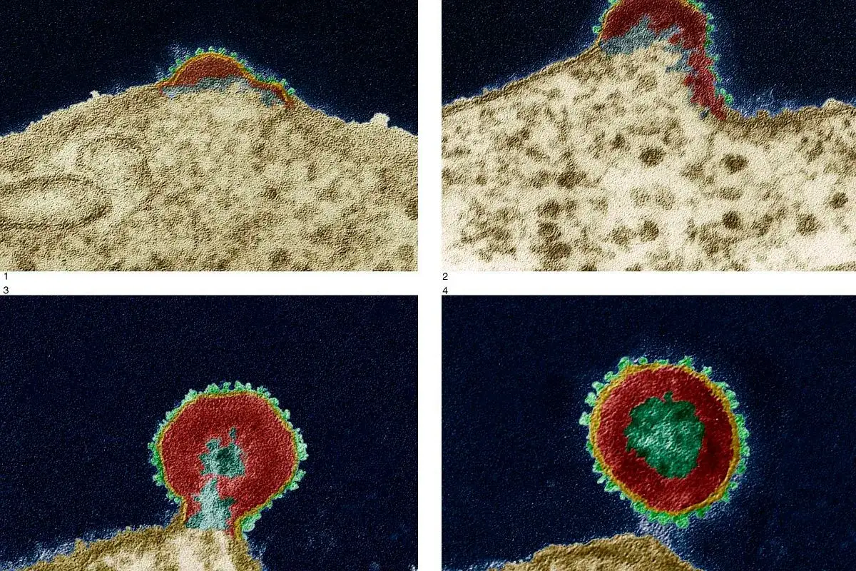 Skąd się wziął AIDS? Zaskakujące fakty o pochodzeniu wirusa HIV