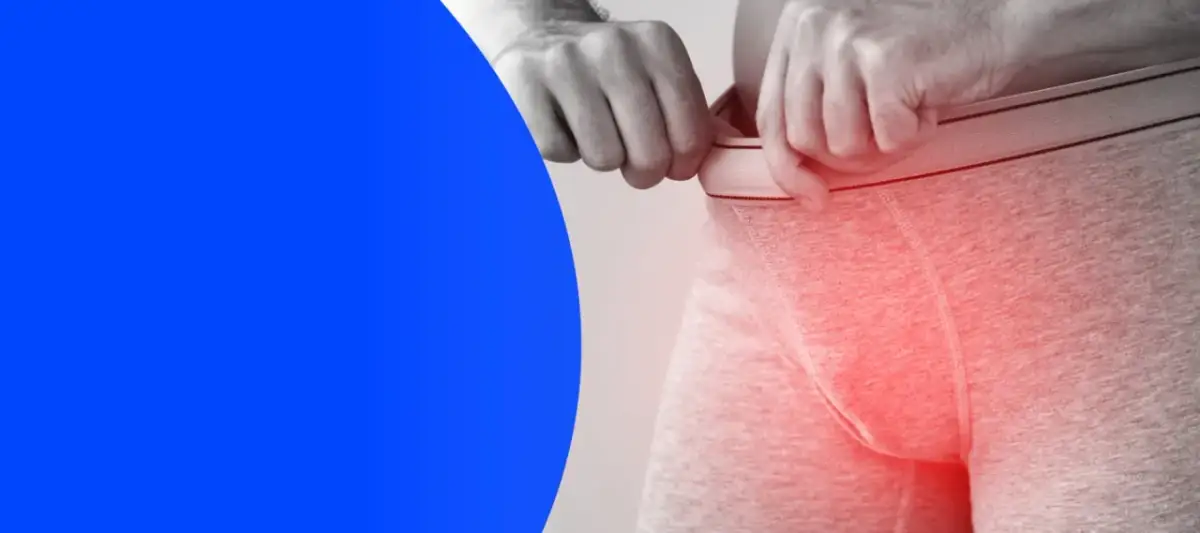 Martwica prącia objawy: jak rozpoznać i uniknąć poważnych skutków