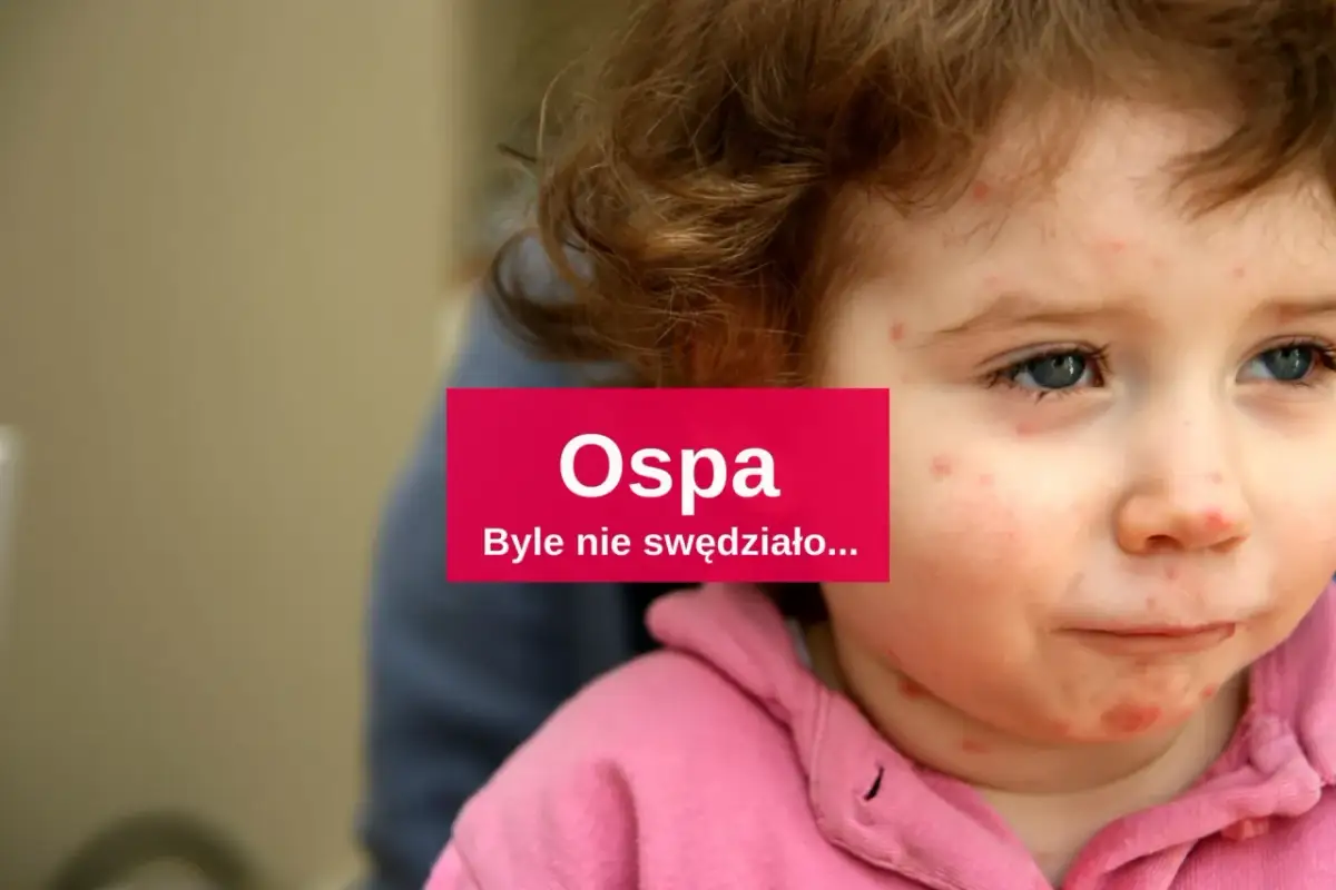 Jakie leki na ospę u dzieci? Skuteczne metody łagodzenia objawów