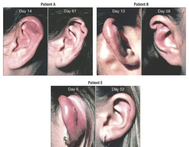 Gdzie zrobić kolczyki? Przewodnik po piercingu: uszy, nos, ciało