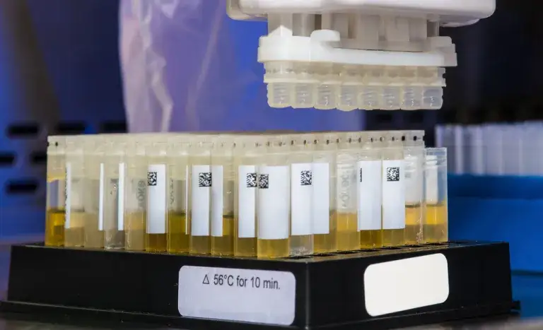 Czy badanie krwi wykryje amfetaminę? Co musisz wiedzieć o testach