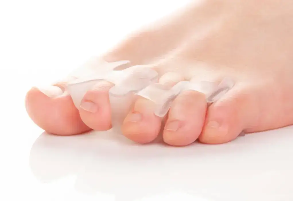 Separatory na haluksy: Czy naprawdę działają? Opinie i zastosowanie