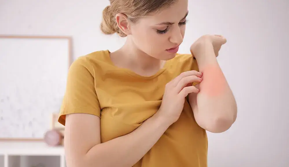 Alergia na roztocza: objawy skórne, AZS i jak sobie z nimi radzić