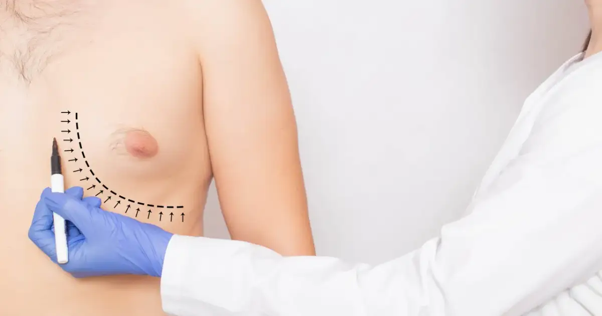 Leczenie ginekomastii: Skuteczne leki na receptę i co musisz wiedzieć?