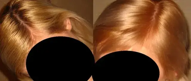 Jak przyciemnić żółty odrost i uzyskać idealny chłodny odcień