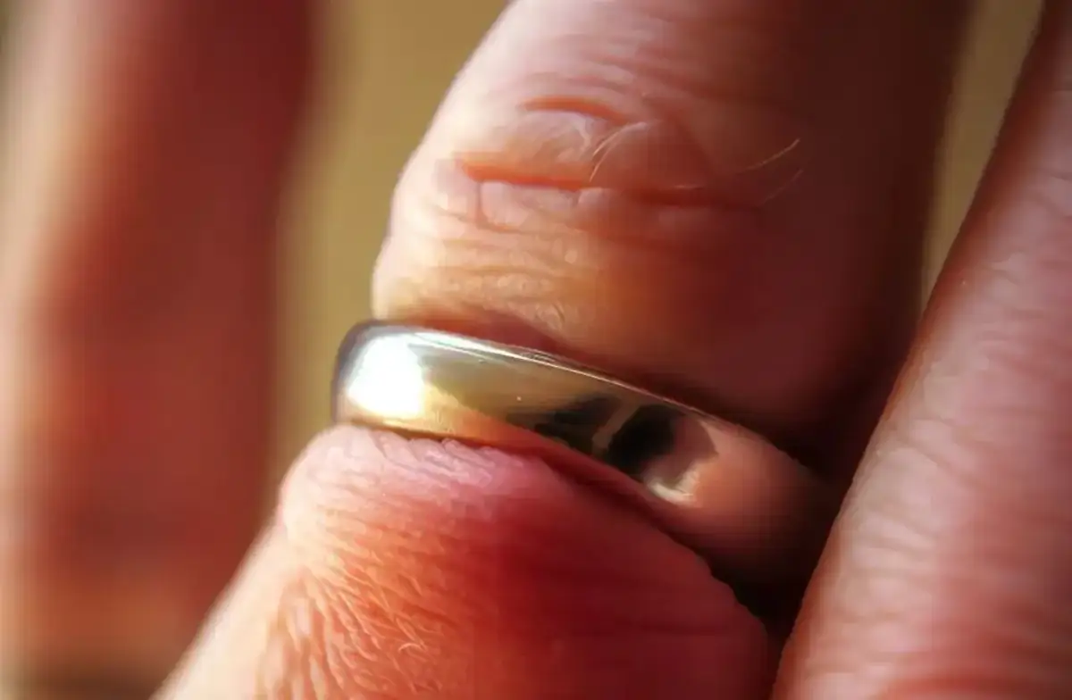 Przecięcie obrączki: koszt, gdzie i jak to zrobić bezpiecznie?