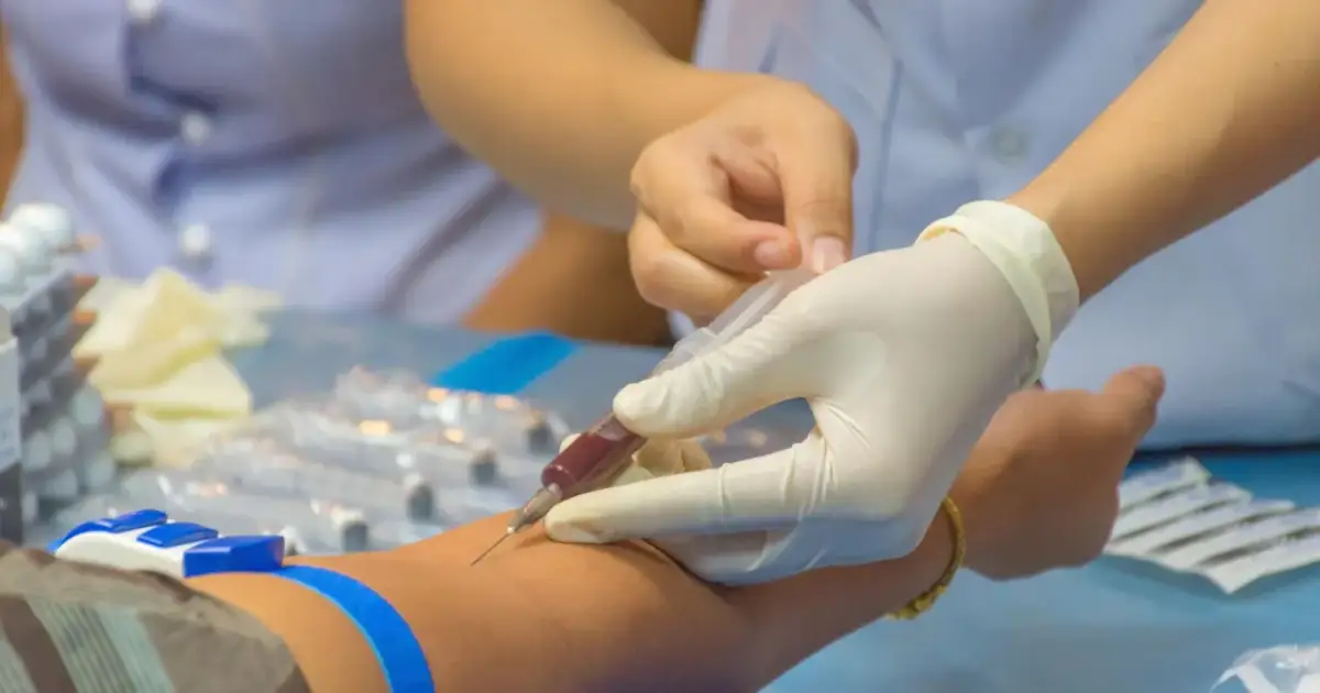 Zaburzenia hemostazy: objawy skaz krwotocznych i nadkrzepliwości