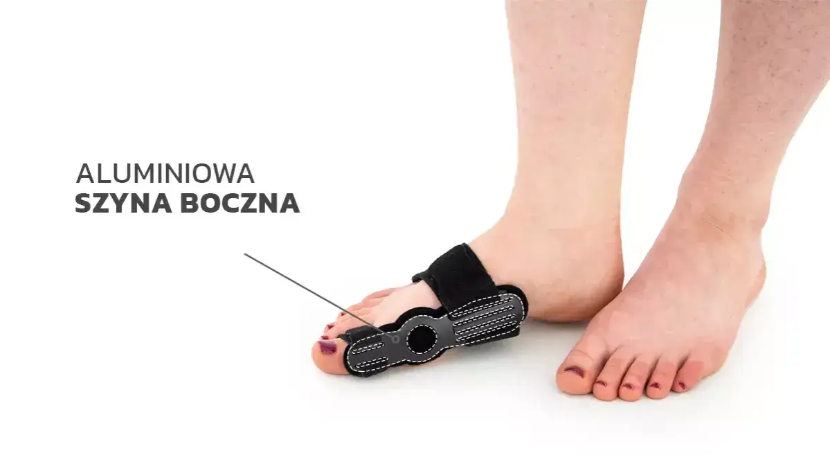 Najlepsza orteza na haluksy – wybierz skuteczne rozwiązanie dla siebie
