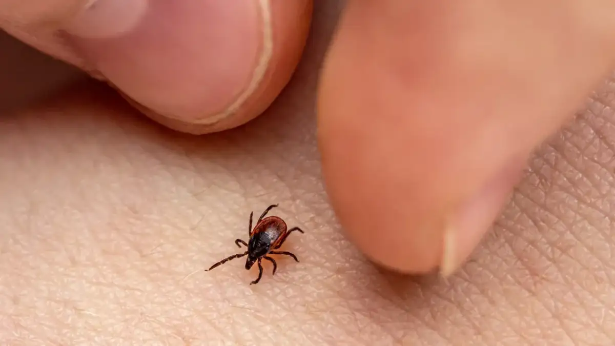 Garrapata marrón sobre piel humana, cerca de los dedos.