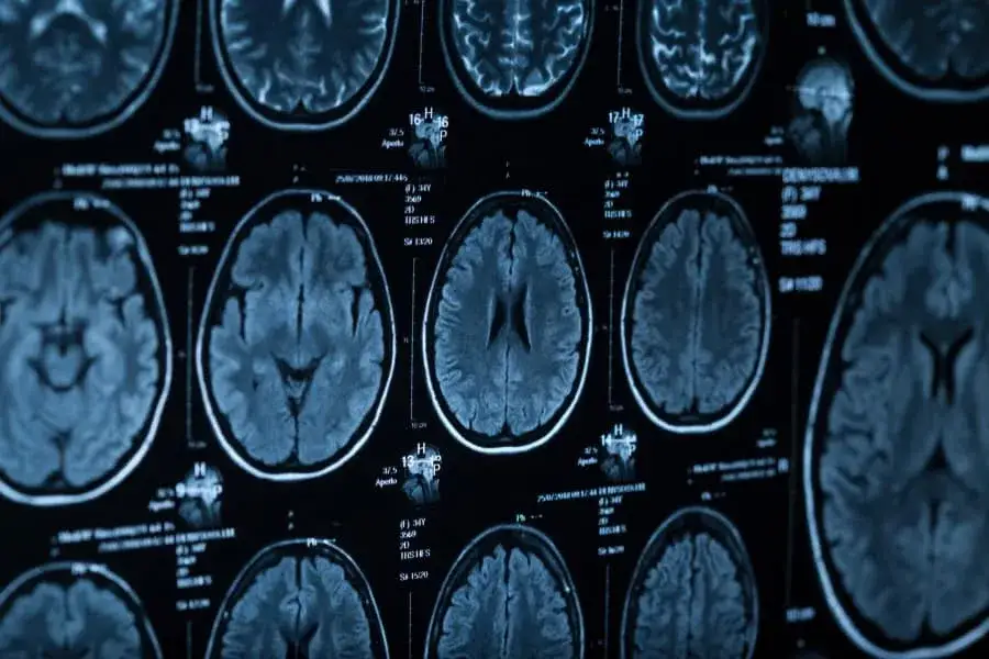 Ile trwa tomograf głowy? Poznaj czas badania z kontrastem i bez