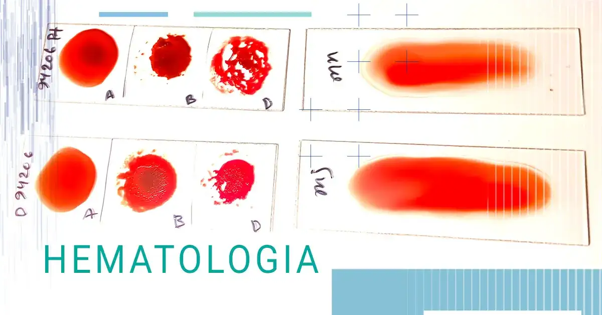Zaburzenia hematologiczne co to - objawy, przyczyny i leczenie