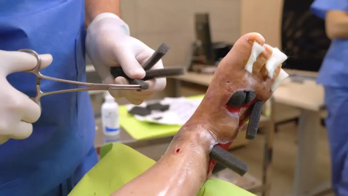 Kanarek kuleje? Leczenie łapek, odciski, pododermatitis!