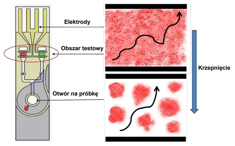 Badanie PT - co to za badanie i dlaczego jest tak ważne?