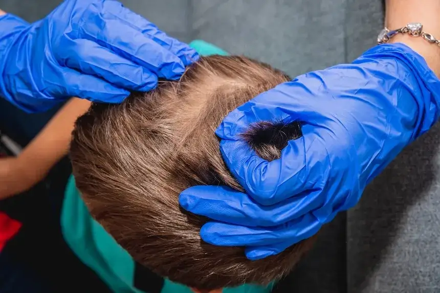 Czy dziecko z wszami może chodzić do przedszkola? Ważne informacje