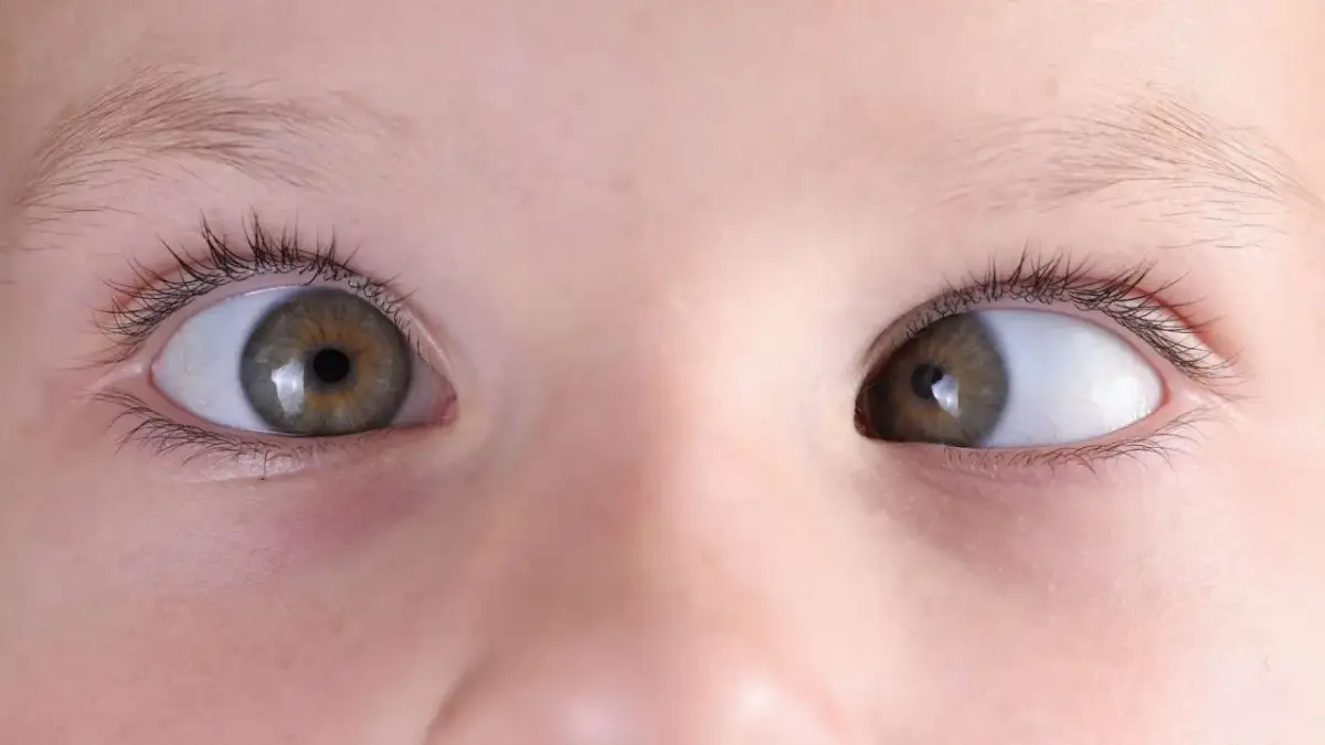 Zez ukryty u dziecka objawy – nie przegap tych ważnych sygnałów