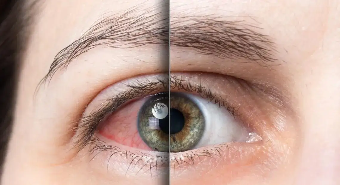 Co nie wolno przy jaskrze? Unikaj tych szkodliwych działań dla zdrowia oczu