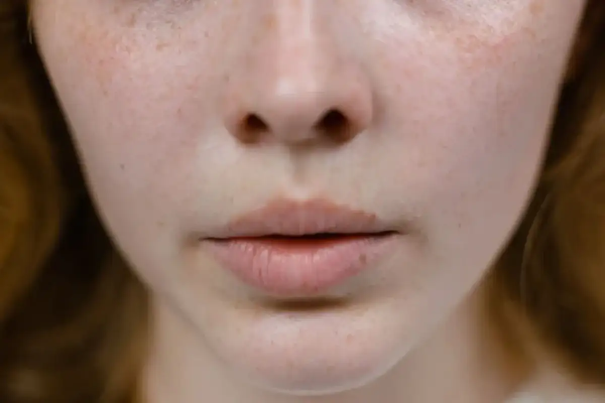 Zapchana cera? Rozpoznaj objawy i odblokuj pory krok po kroku!