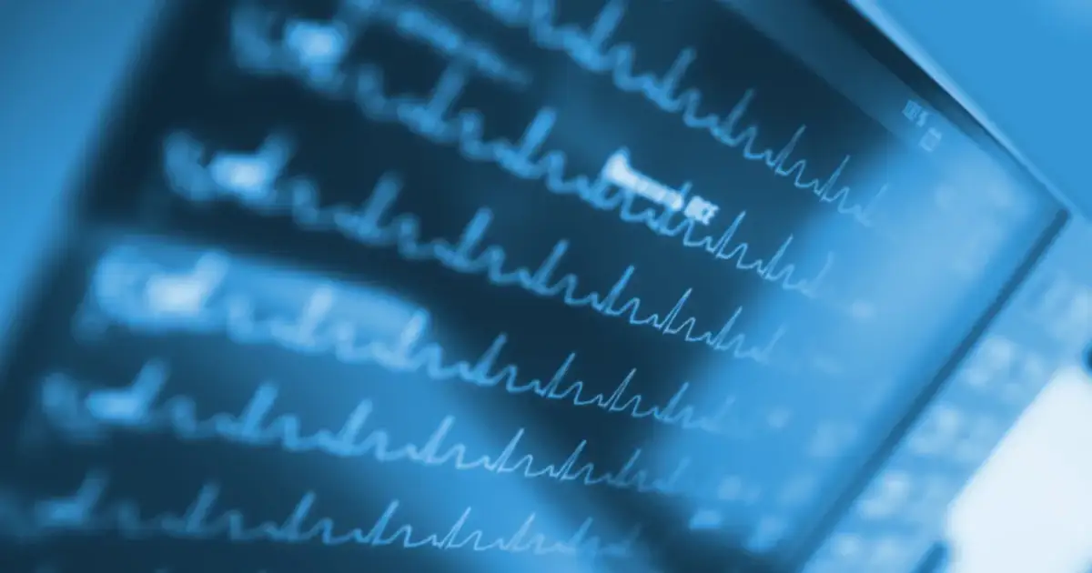 Migotanie przedsionków: Rozpoznaj objawy, uniknij udaru. Działaj!